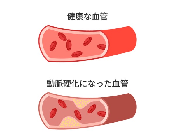 4231